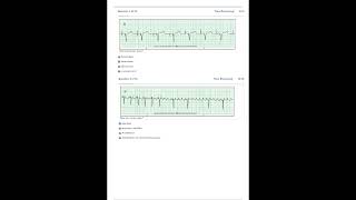 Relias Dysrhythmia Basic Test Answers 2023 Dysrhythmia – Basic A A GRADED 100 VERIFIEDPDF [upl. by Ahseinek931]