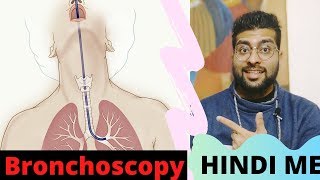 Bronchoscopy Explained in Hindi  ब्रोंकोस्कोपी क्या है  Types of Bronchoscopy [upl. by Aubrie108]