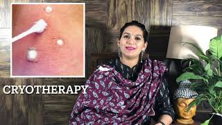 Molluscum Contagiosum Treatment  What is Molluscum contagiosum  Red bumps on face  मस्से का इलाज [upl. by Saval130]