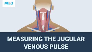 Measuring the jugular venous pulse [upl. by Anivel]