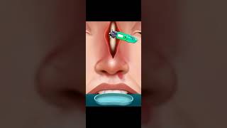 Nose job Rhinoplasty Asmr animation  video animation Mr Welcome [upl. by Pail]