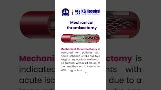 Mechanical Thrombectomy [upl. by Armitage]