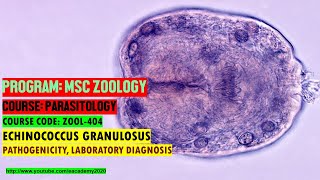 Echinococcus granulosus Pathogenicity and Laboratory Diagnosis [upl. by Shauna624]