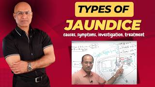 Types Of Jaundice  Causes Symptoms amp Treatment  Dr Najeeb [upl. by Annaehr283]