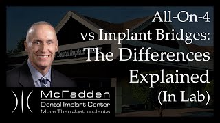 AllOn4 vs Implant Bridges Explained In The Lab [upl. by Hegarty978]