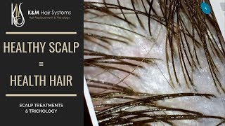 HEALTHY SCALP  HEALTHY HAIR  TRICHOLOGY [upl. by Ettegirb198]