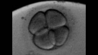 Rotation of the blastomeres at 4cells human embryoavi [upl. by Witty425]