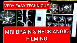 Brain and Neck Vessels MRI Angiography filming Protocol [upl. by Violet335]