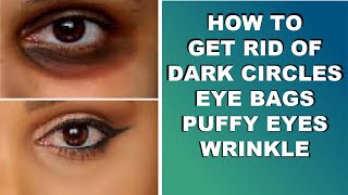 Tips On How To Get Rid Of Dark Circles Eye Bags And Puffy Under Eyes  Wrinkles And Crows Feet [upl. by Tdnerb]