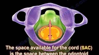 C  Spine Instability Flexion Extension Xrays  Everything You Need To Know  Dr Nabil Ebraheim [upl. by Orrin]