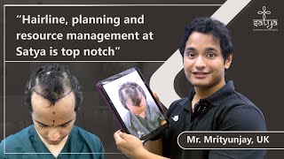 Hairline Transplant Delhi  Hairline Transplant Timelapse  Hairline Transplant  Satya Hair Clinic [upl. by Greenfield]