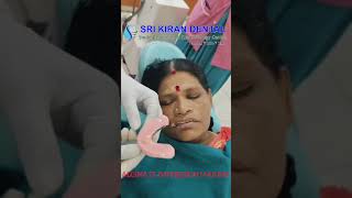 Alginate Impression Taking I impression making I Srikiran Dental [upl. by Kiefer]