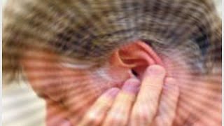 Hearing Loss Remedies  Natural Remedies for Hearing Loss [upl. by Nwahsd]