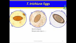 Trichuris trichiura Nematodes [upl. by Alleber53]