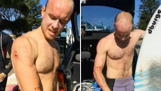 ‘I just punched it in the face’ Surfer describes fending off shark [upl. by Llerehs]