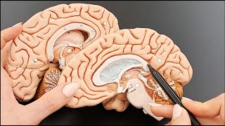 Brain Anatomy Cross Section Structures  MADE EASY  Part 3 of 5 [upl. by Krenn]