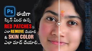 Photoshop Trick Remove Red Patches Like a Pro  Skin Color Matching Tips  creative space telugu [upl. by Dahlstrom825]