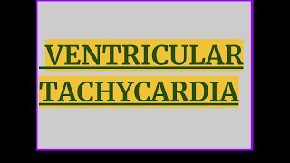 VENTRICULAR TACHYCARDIA [upl. by Akeihsat]