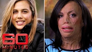 Turia Pitt was burned alive during an ultramarathon  60 Minutes Australia [upl. by Airtap]