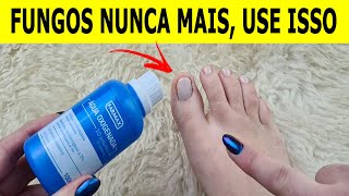 NUNCA MAIS TIVE FUNGOS E MICOSE NAS UNHAS DEPOIS QUE VI ESSA RECEITA [upl. by Aratahs665]