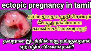 ectopic pregnancy tamilectopic pregnancy signs amp symptoms in tamilectopic pregnancy symptoms [upl. by Ialocin]