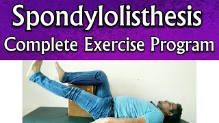 Spondylolisthesis EXERCISES  Effective Exercises For Spondylolisthesis TREATMENT At Home Naturally [upl. by Eetnahc]