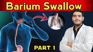 Barium swallow test  indication contraindications procedure  complete studybarium [upl. by Drusi]