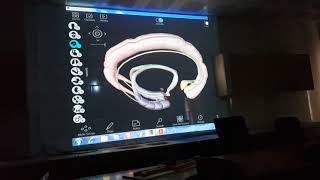 Lobus limbicusLimbik Sistem Anatomisi Netter3D Atlas üzerinden anlatımNöroanatomi 1Bölüm [upl. by Ridan323]