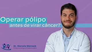 Operar pólipo de intestino de forma preventiva Assista até o final [upl. by Leontina]