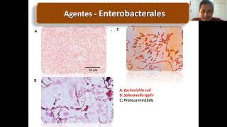 Enterobactérias  Bactérias de Interesse em Saúde  Parte 5 [upl. by Runck837]