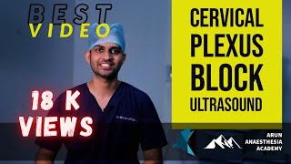 CERVICAL PLEXUS BLOCK INTERMEDIATE AND SUPERFICIAL ULTRASOUND GUIDED  UPDATE MYTHS IN NOMENCLATURE [upl. by Tletski]