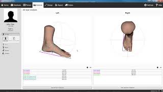 RSscan 3D Foot Scanners [upl. by Far171]