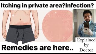 Itching over Groin area Remedies are here  Home remedies itching and infection in private part [upl. by Ariahs]