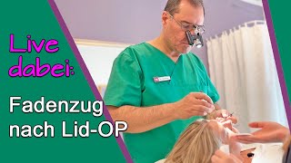 AugenlidOP – Erfahrungsbericht Fäden ziehen nach SchlupflidOP bei Dr Günther Düsseldorf [upl. by Dyson]