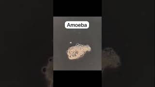 amoeba nutrition in amoeba ingestion of food through pseudopodia amazing animals protozoa [upl. by Rojam]