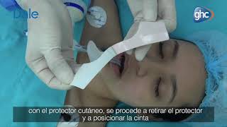 Tubo endotraqueal de la marca Dale para Global Healthcare [upl. by Anitsyrk]