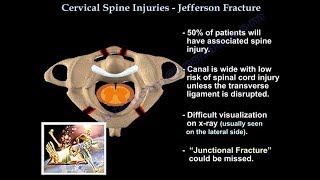 Jefferson Fracture  Everything You Need To Know  Dr Nabil Ebraheim [upl. by Lecia]