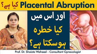 Placenta Abruption Kya Hai  What To Do In Placenta Abruption  Placenta Abruption Treatment [upl. by Ennyl]