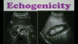 Echogenicity Ultrasound ultrasoundecgogenicity sonology [upl. by Nylyrehc]