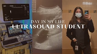 Day in my life as an ULTRASOUND STUDENT [upl. by Eelirem141]