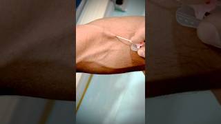 Mastering Canalization A StepbyStep Guide to Expert IV Catheterization highlight toptrending [upl. by Kylah]