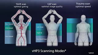 Aquilion Prime SP  Complete Clinical Capability [upl. by Ghassan]