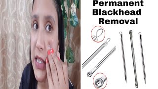 Remove Permanently BlackHeads at Home Using Stainless Steel Blackheads Remover Needles [upl. by Haskins]