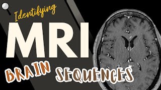 Identifying MRI Brain Sequences [upl. by Kriste]