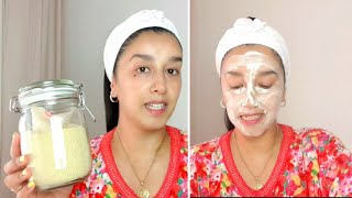 Mascarilla natural para tratar las MANCHAS OSCURAS y MARCAS de ACNÉ [upl. by Nipahc629]