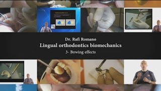 Dr Rafi RomanoLingual orthodontics biomechanics 3 bowing effects [upl. by Nojad870]