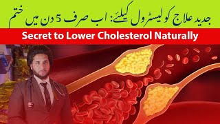 High Cholesterol Diet Plan Causes Symptoms amp Treatment  Cholesterol Aise Kam Karen  कोलेस्ट्रॉल [upl. by Packston]