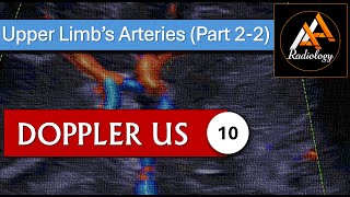 10  Upper Limbs Arteries Part 22 [upl. by Burgess]