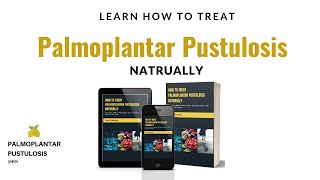 How To Treat Palmoplantar Pustulosis PPP Naturally [upl. by Salohcin]