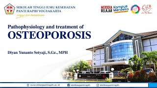 Pathophysiology of Osteoporosis [upl. by Reginauld]